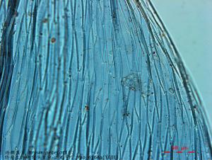 Bryum petelotii Thér. & R. Henry 培鐵真苔顯微照