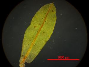 Hyophila involuta (Hook.) A. Jaeger 葉片顯微照