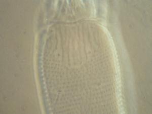 Phytoptus formosanus Wang & Huang, 2011硬皮板